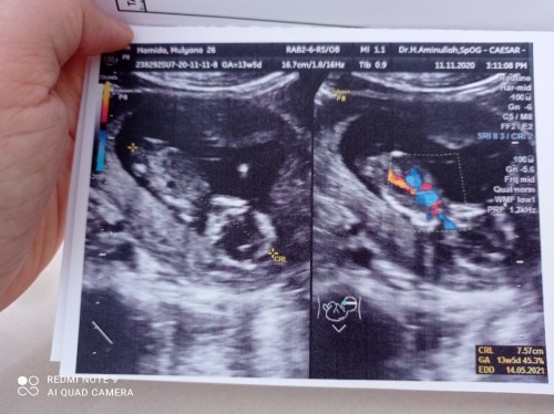 Wijaya Journey๐ถ๐ป