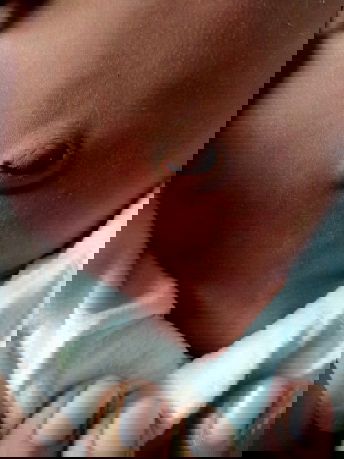 น้องมีผืนเเดง