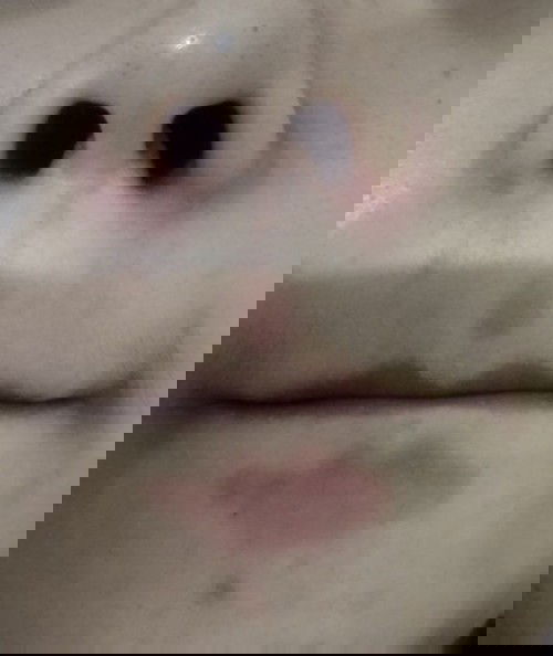 Kehamilan 11w muka kering