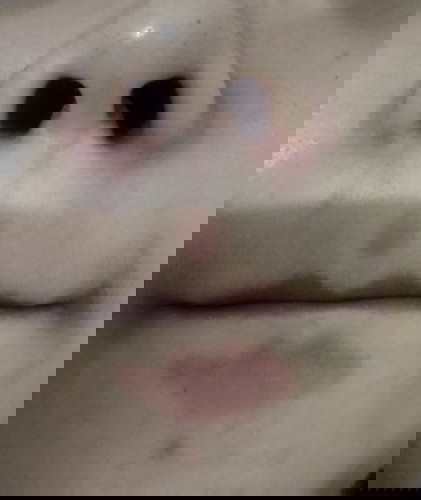 Kehamilan 11w muka kering