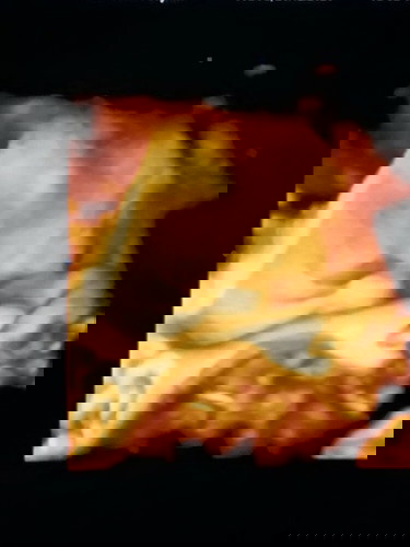 มีบ้านไหนคลอดเดือนธันวาบ้างค่ะ