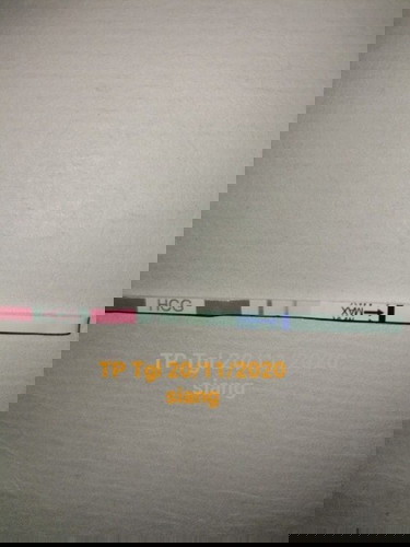 Testpack garis dua tp diagnosa dokter berbeda sekali