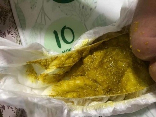 Is this diarrhea or normal?