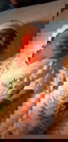 Baby out via NSD 💕