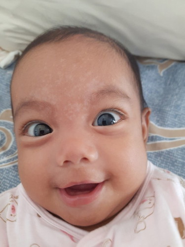 Paano maalis nang safe ang An an