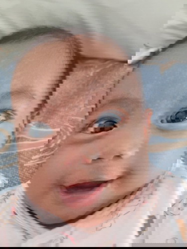 Paano maalis nang safe ang An an