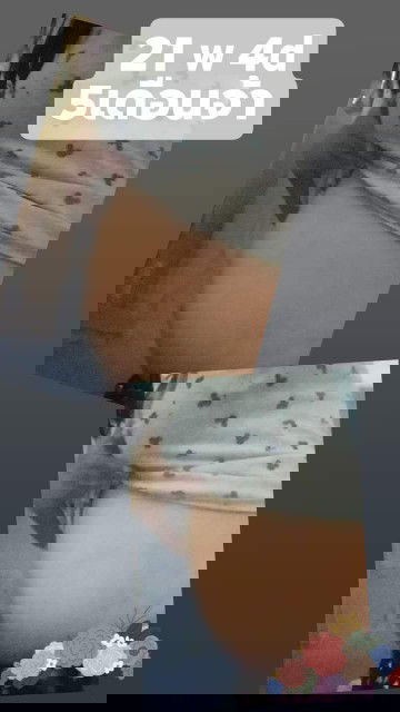 ลักษณะท้องแบบนี้ผู้หญิงหรือผู้ชายคะ ใครมองเป็นช่วยมองหน่อยค่าาา