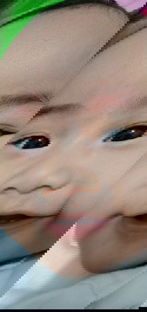 bercak putih disekitar mata