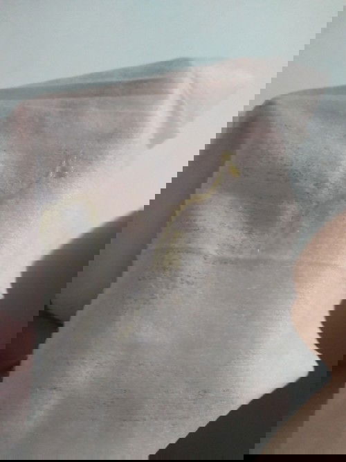 เป็นแบบนี้ปกติหรือป่าวคะ?