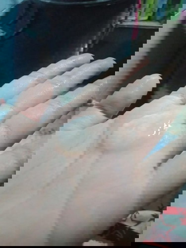 ใช่มูกมั้ยคะ ไม่มีเลือดปน 37+2