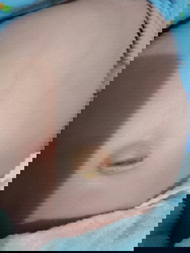 Pusar bayi masih belum kering setelah puput