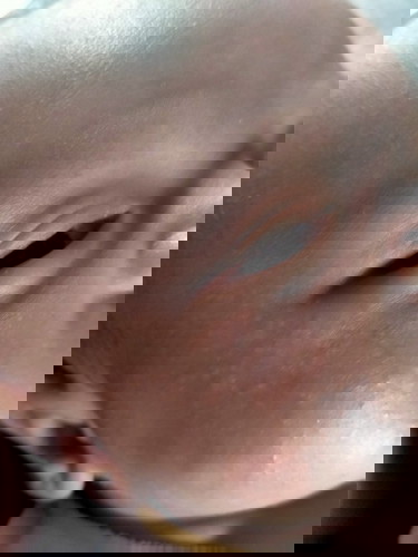 bintik merah