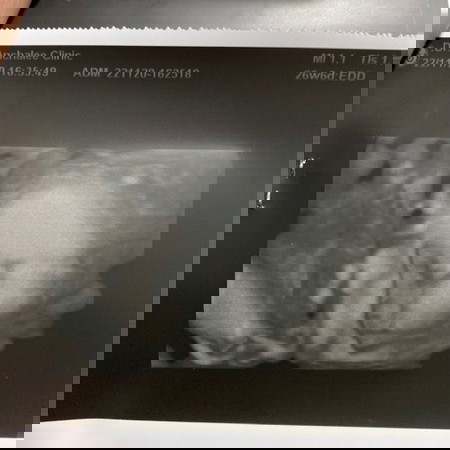 เพิ่มน้ำหนักลูก