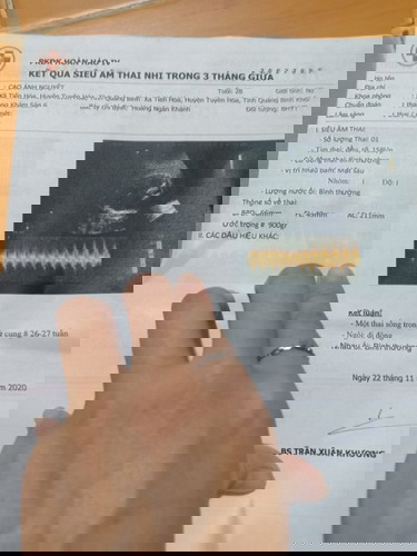 Minh 27 tuan be đc 913g .co nho qa khong a