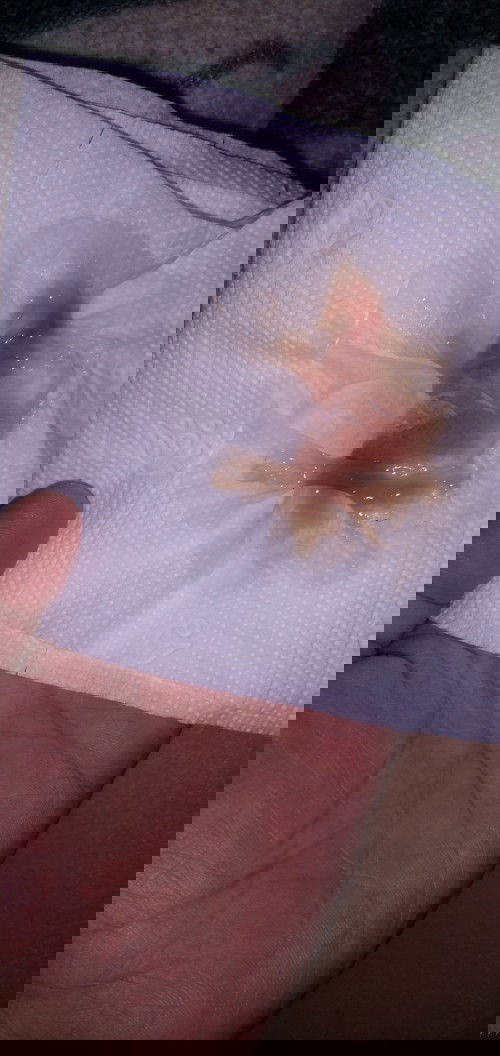 Preggy 38 weeks today, already had discharge yesterday 5am sticky brown and around 12nn sticky white