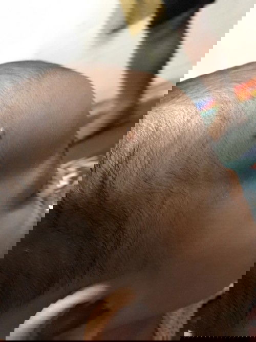 Ketulan di kepala baby