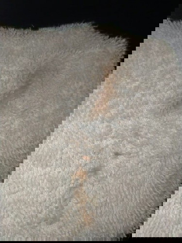 มูกเลือดใช่ไหมคะ