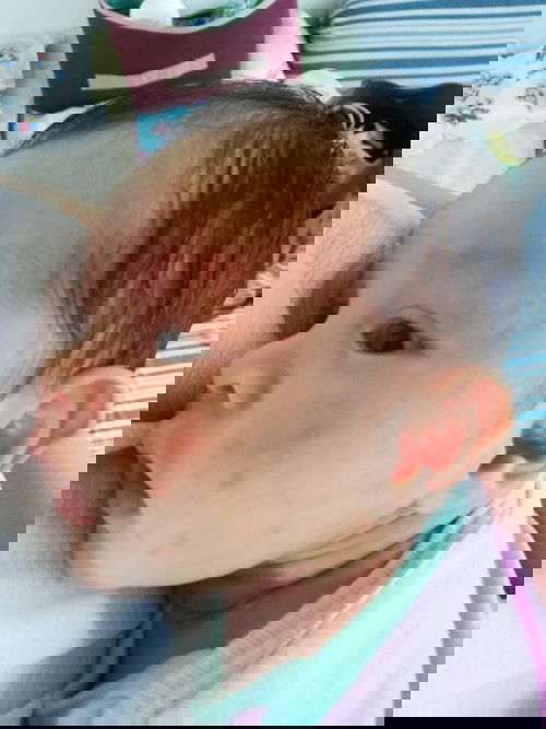 May Rashes si baby😢