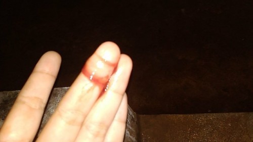 ใครเคยเป็นมั้ยคะ