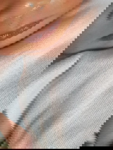 Color of lips