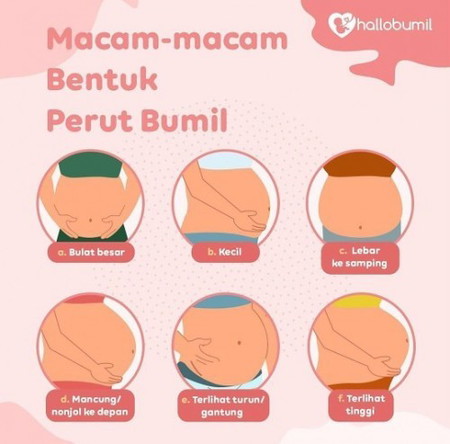 Bentuk Perut Bumil