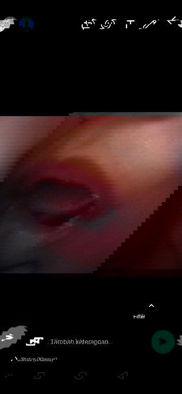 putih putih d mulut bayi