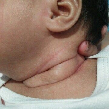 acne rushes turn to white spot.