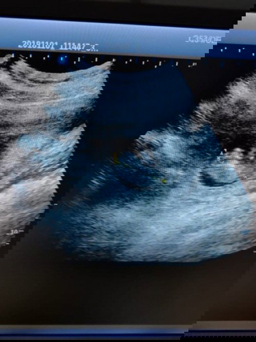 Vitamin nya kurang gak yah?