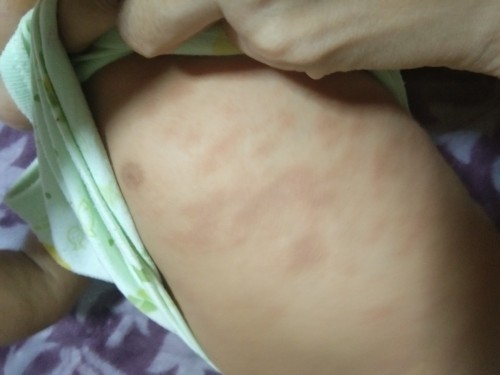 กังวลและเครียดมาก