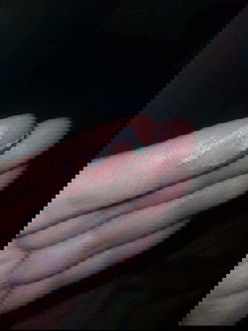 33+6มีเมือกออกแบบนี้อันตรายไหมคะ