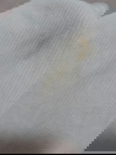 Spotting ba to? Hello po ano sa tingin nio po spotting or pee stain lang po?