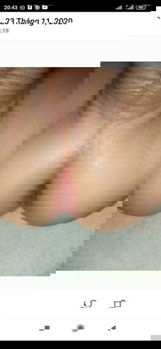 Đây có phải bị hăm tả ko mọi người chỉ mình với