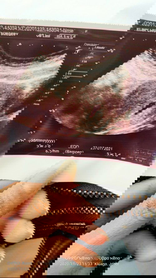 5 weeks 4 day 🤲🤲🥰🥰