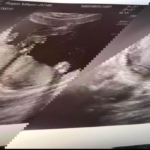 ไม่หุบให้แม่ลุ้นหน่อยหรอลูก 😬
👶🏻/👧🏻?