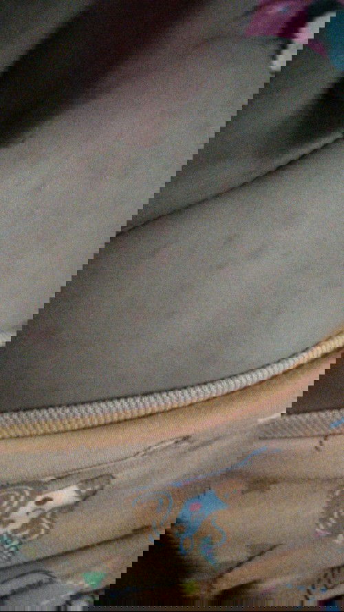 Gabagen (kata orang jawa ) benarkah sama dengan Campak rubeola.?