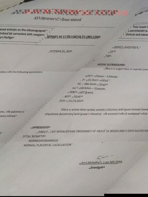 Okay lng po ba Iyong ultra sound ko?
