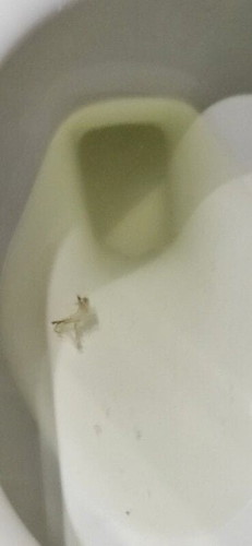 Brown discharge 7weeks