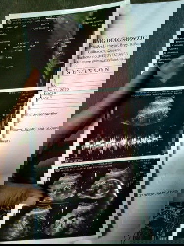 Asking for ultrasound