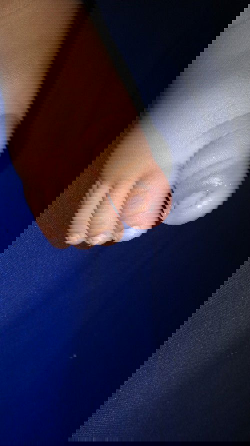 Obat cantengan buat bayi apa ya yg ampuh bgt?