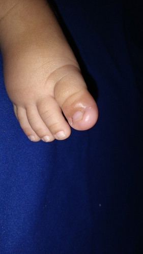 Obat cantengan buat bayi apa ya yg ampuh bgt?