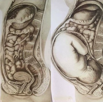 Hello po mga mommy asking lang po sino taga Antipolo city dito?