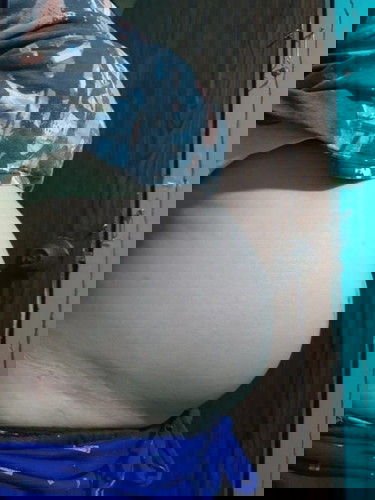 Masakit na balakang at kepay