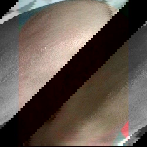 Kepala baby "lecet bantal"