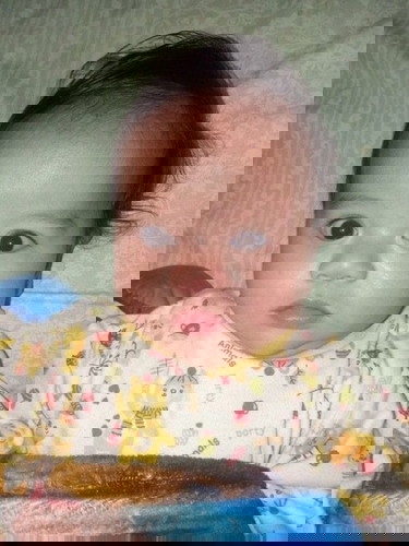 Sembuh dari Impetigo