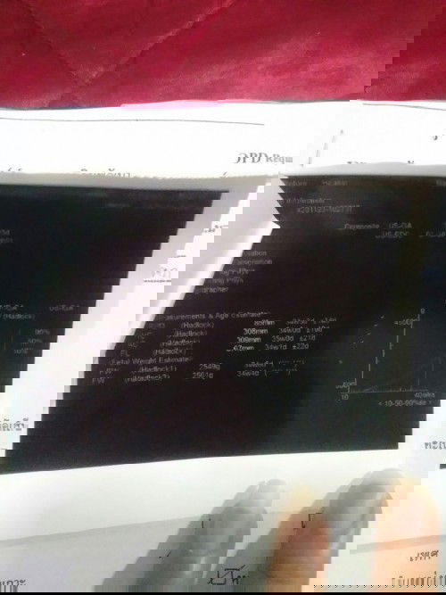 ตั้งครรภ์