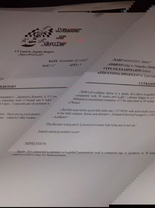 38 weeks Timbang ni baby