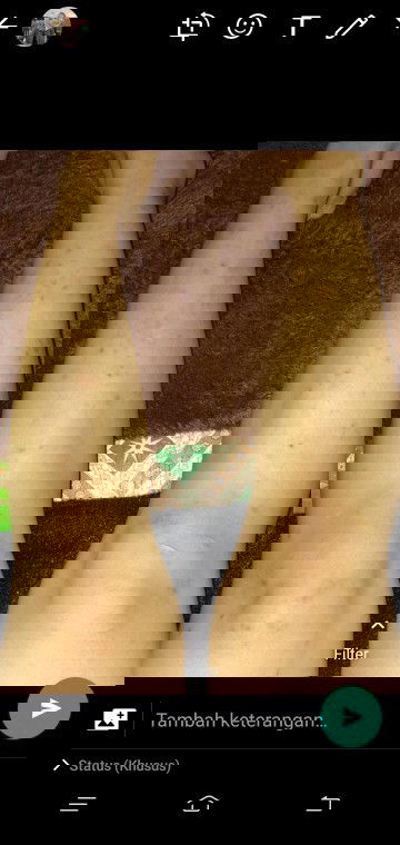 Bintik merah dan gatal"