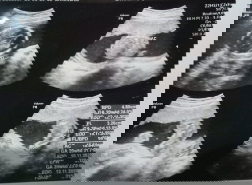 USG, melintang atau bagaimana?