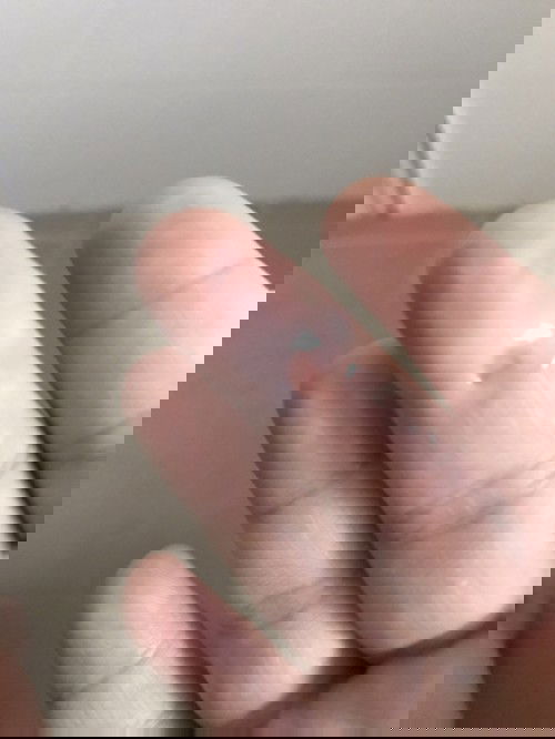 อยากรู้นี่คือตกขาวใช่ไหมค่ะ