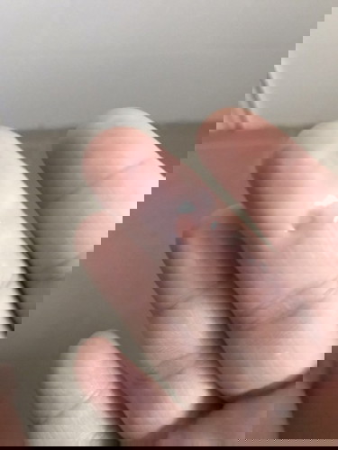 อยากรู้นี่คือตกขาวใช่ไหมค่ะ